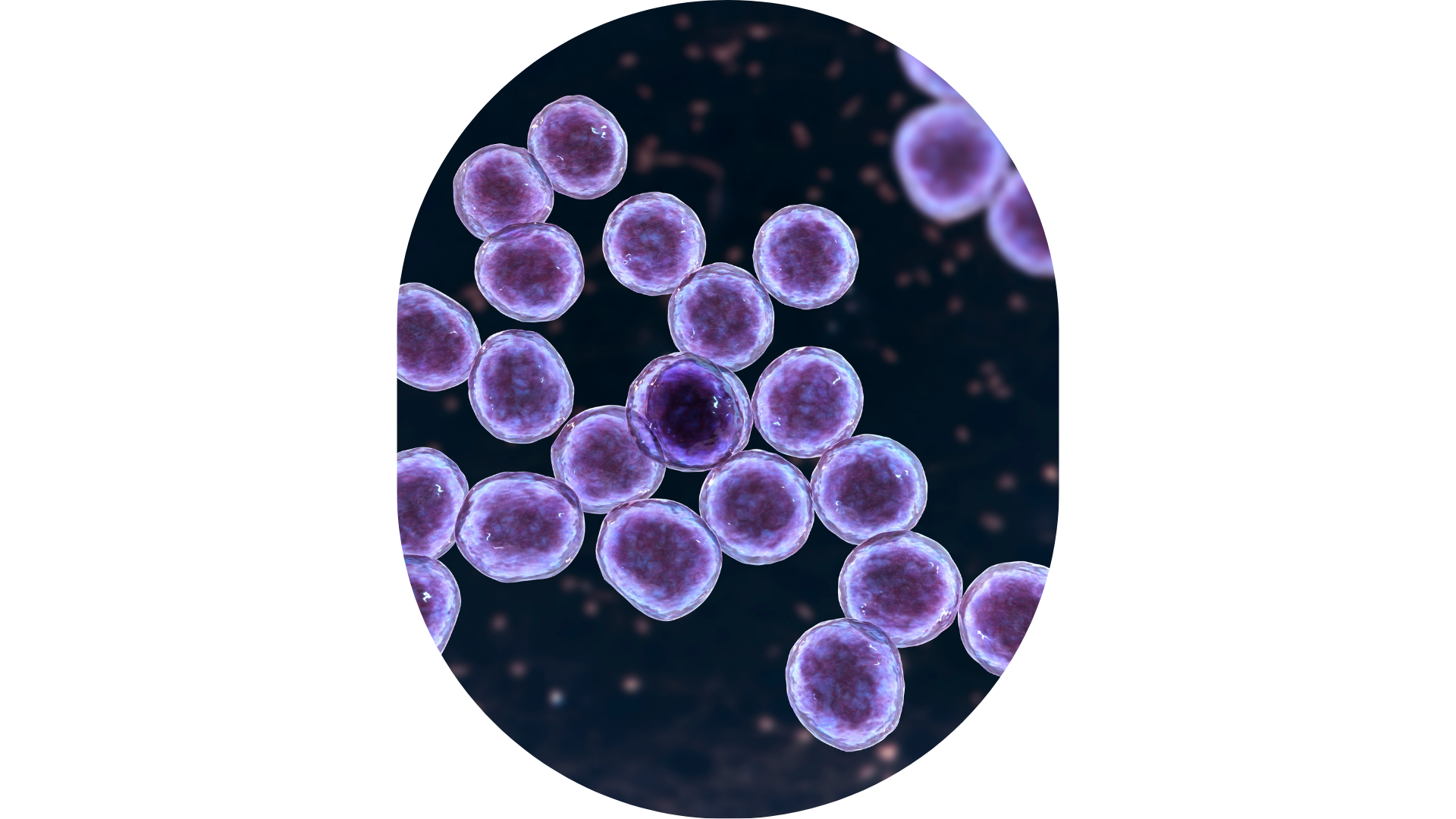 Lactobacillus rhamnosus